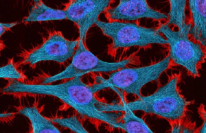 5 Ways Henrietta Lacks Changed Medical Science