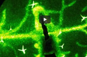 How leaves tell each other about a bug attack