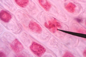 How screening and vaccines drove UK cancer deaths to record lows | The Optimist Daily